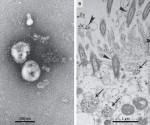 nuevo_coronavirus_2019