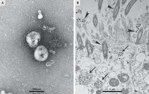 nuevo_coronavirus_2019