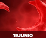 19-de-junio-dm-de-la-drepanocitosis