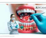 bucodental
